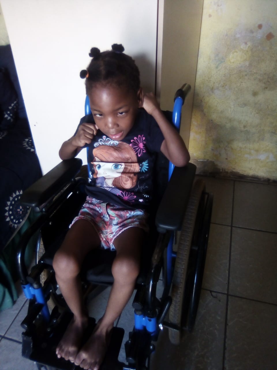 Alexandra child paralyzed after birth and her file stolen at Edenvale Hospital