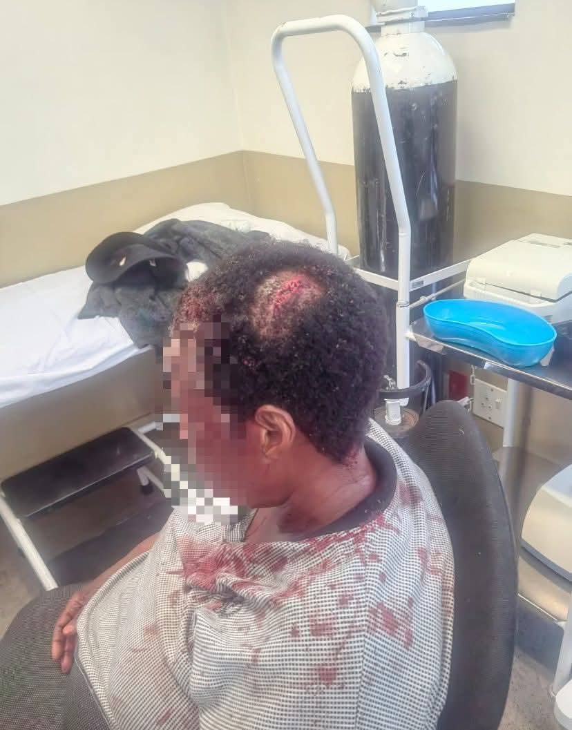 DUDULA MEMBER ATTACKED IN HER OWN HOME — FOREIGN NATIONALS SUSPECTED